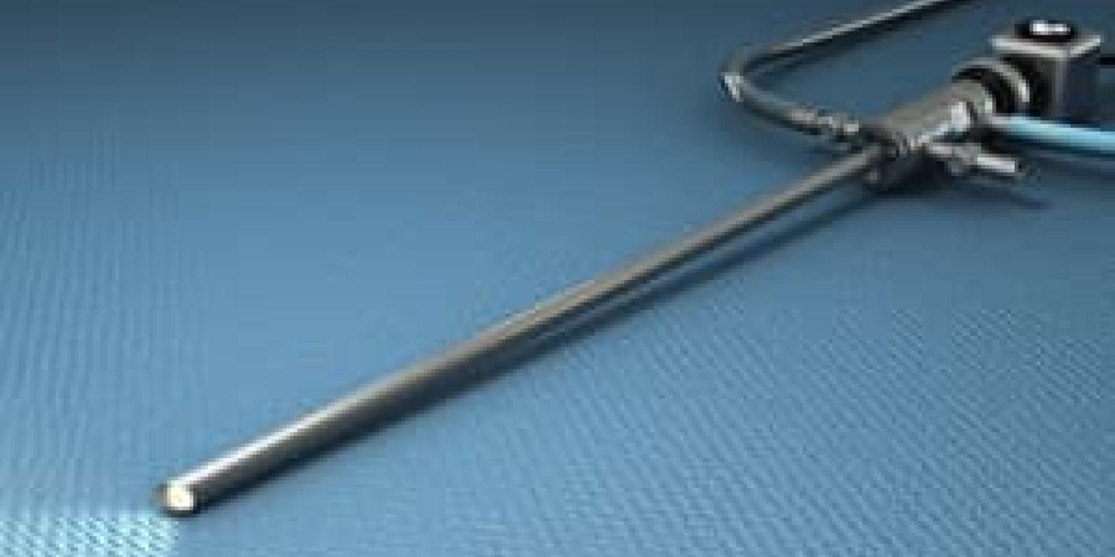 Arthroscopy (Overview)