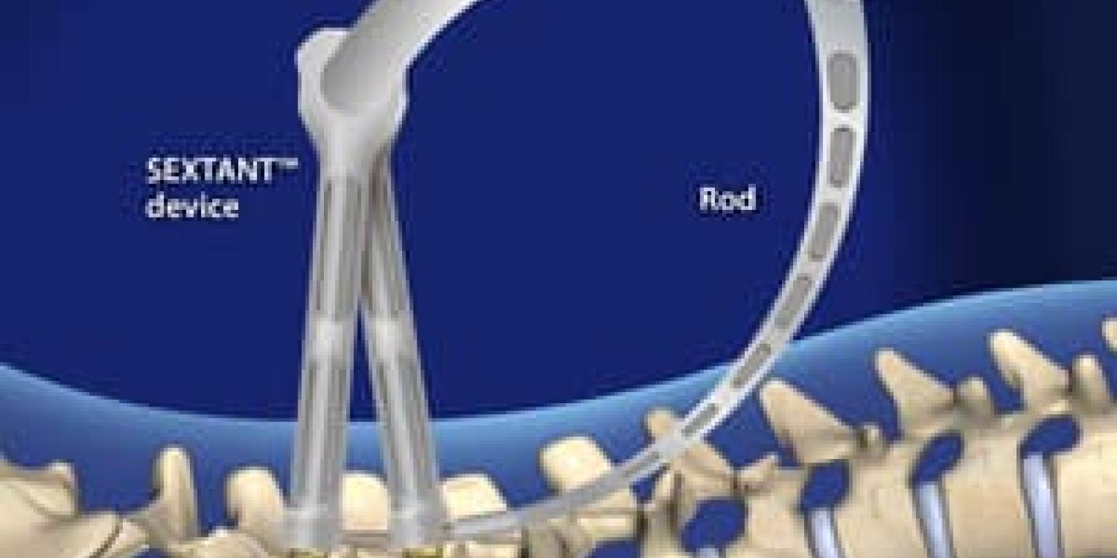 Lumbar Pedicle Screw Fixation