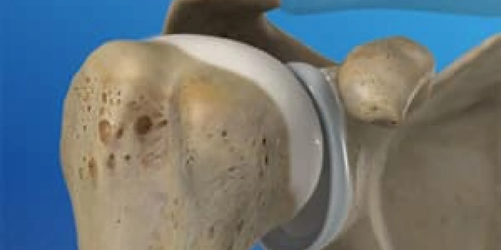 Anatomy of the Shoulder