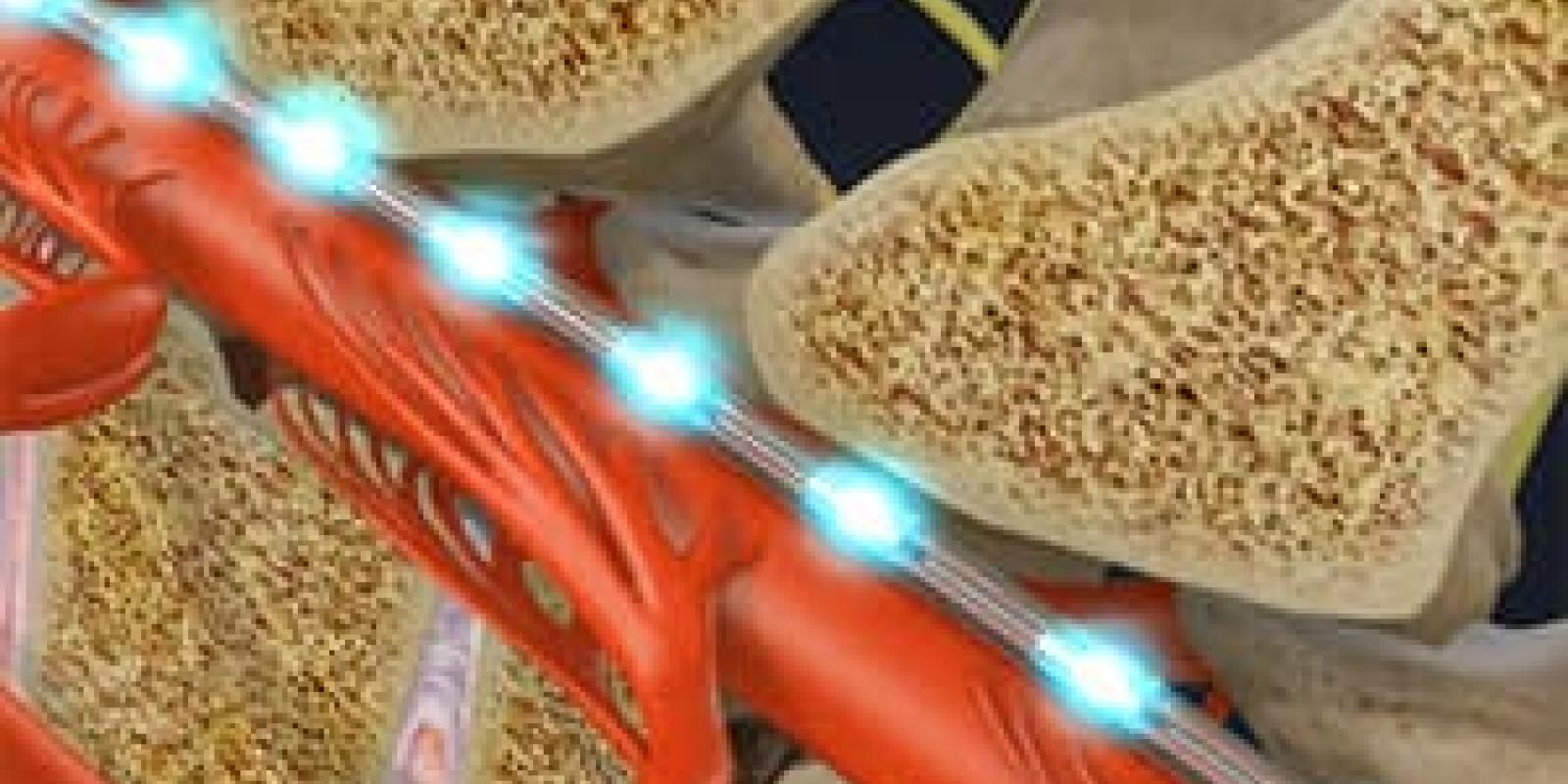 Spinal Cord Stimulator Implant