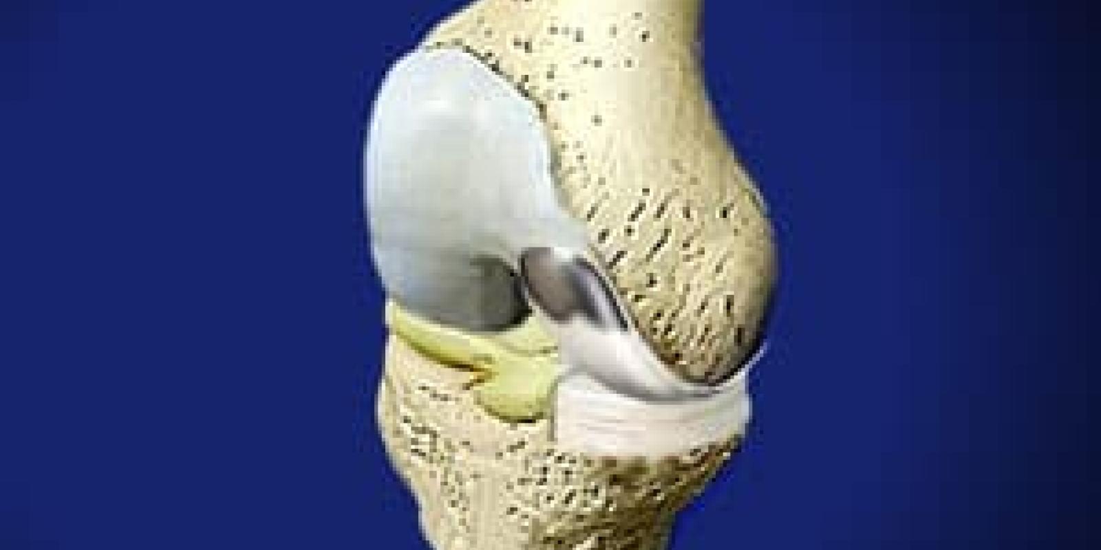 Uni Knee Resurfacing