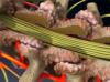 Laminectomy