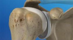 Anatomy of the Shoulder