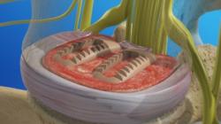 Posterior Lumbar Interbody Fusion (PLIF)
